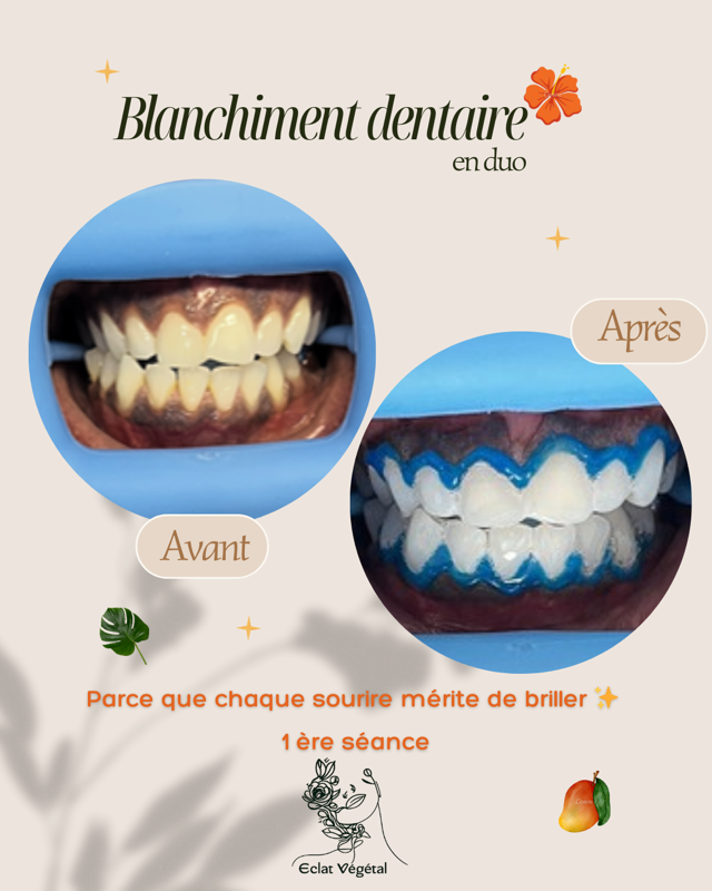 Éclat Végétal
